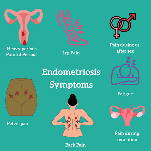 Endometriosis symptoms - breakdown of all the signs and locations